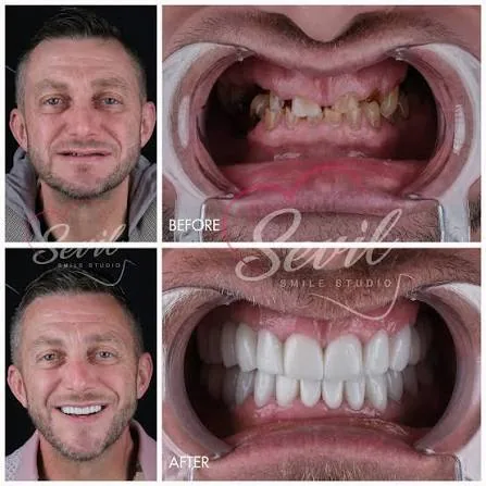 Before and after frames of a fourth patient, shown at the source photograph's own resolution