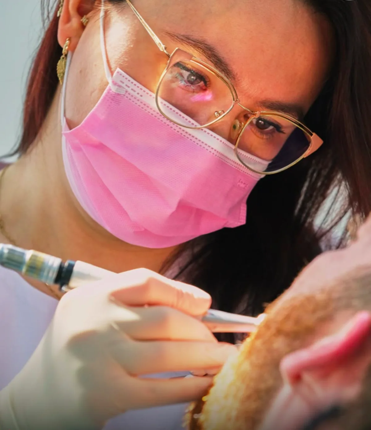 A Sevil Smile Clinic dentist examining a case closely, with loupes