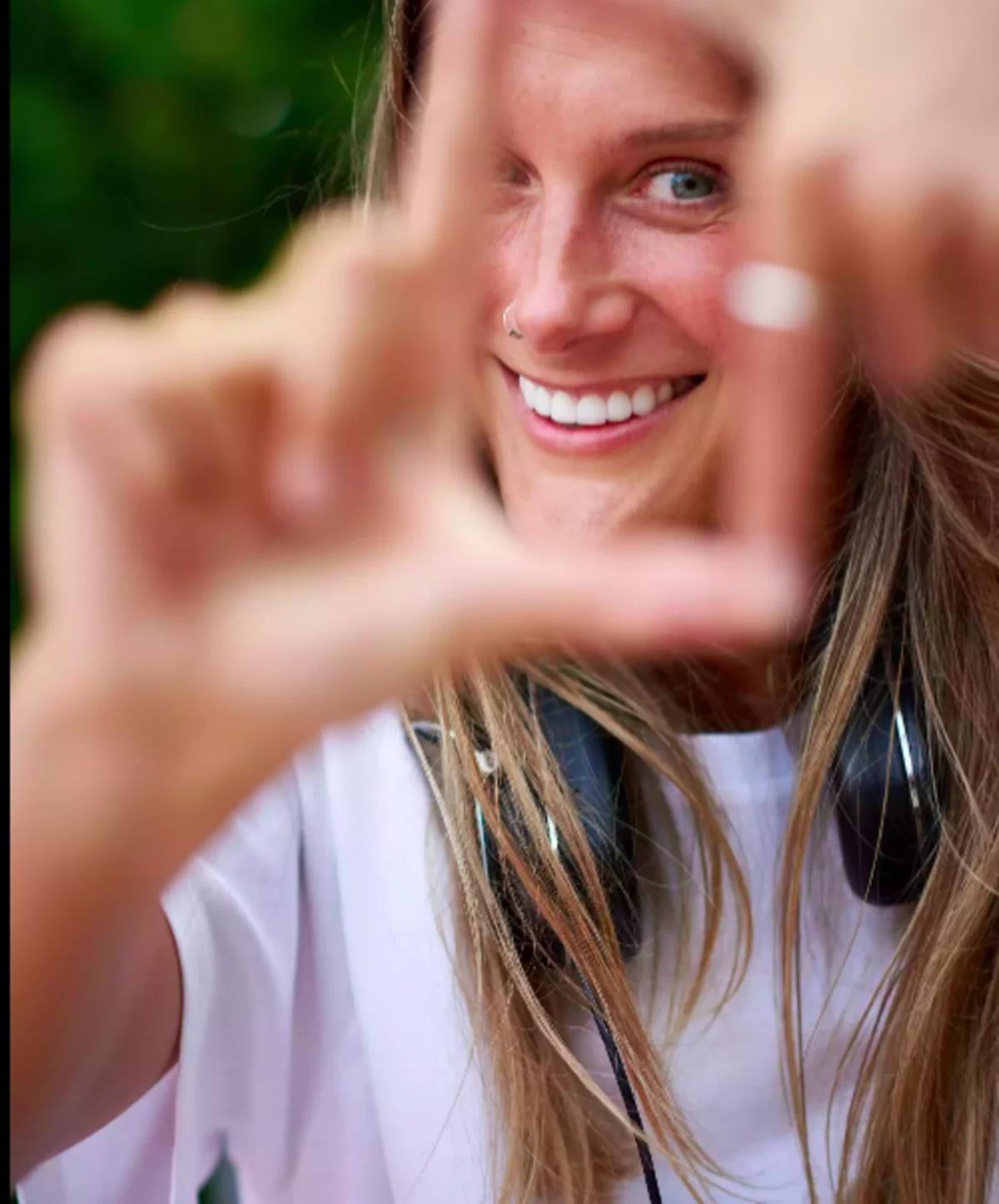 A patient framing her smile with her hands, close up